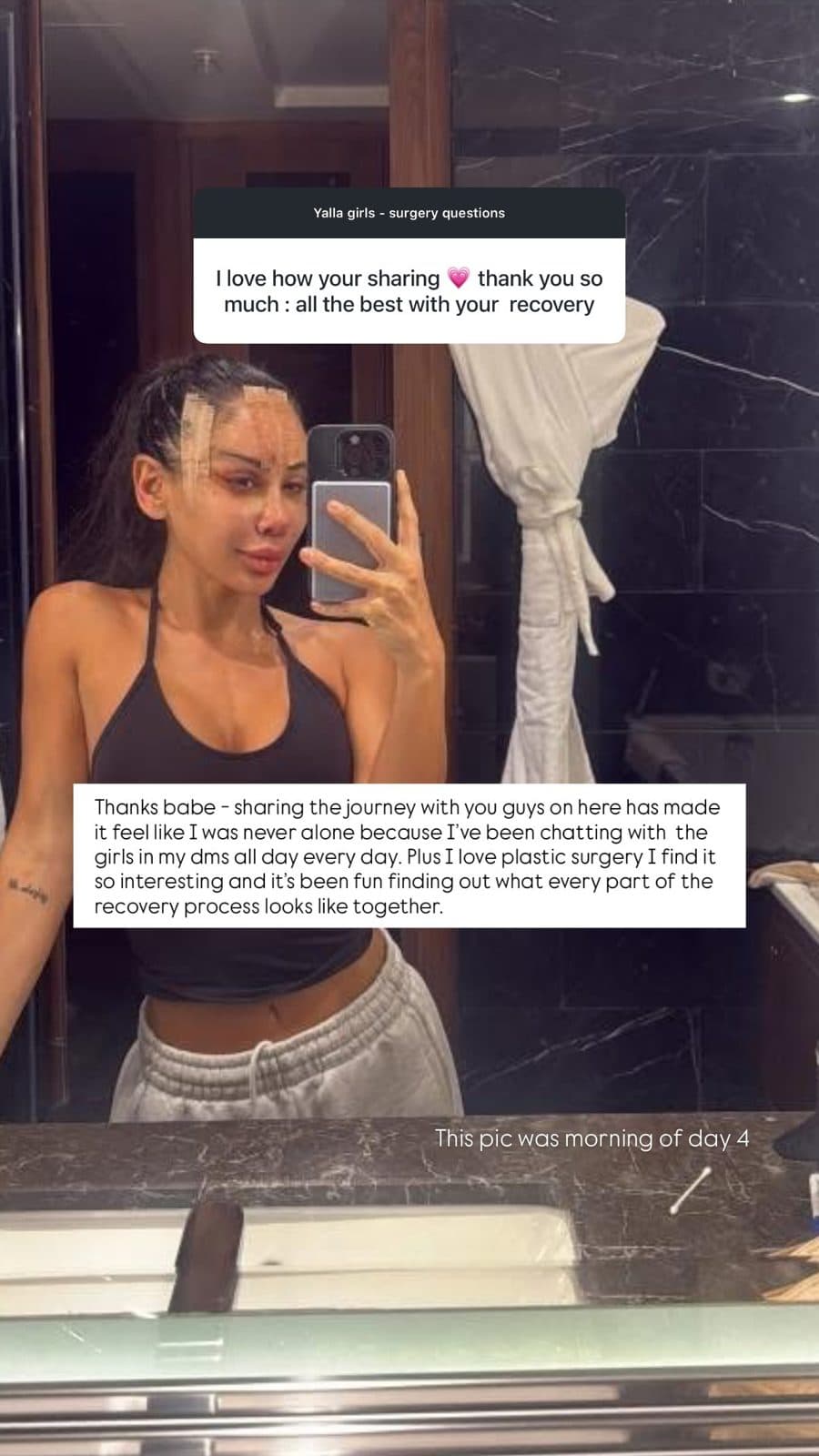 Patient Instagram story: Day 4: sharing the journey