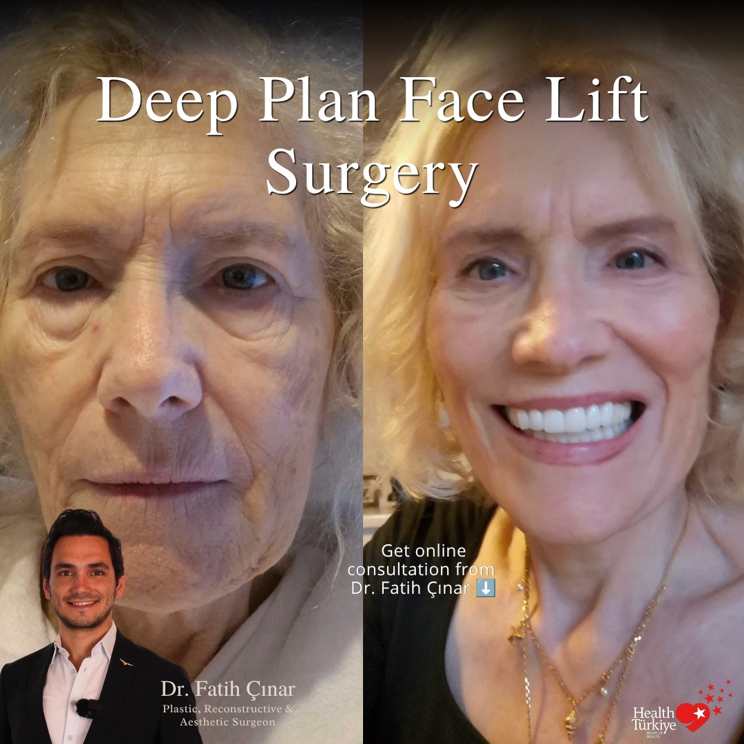 Deep Plane